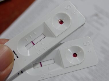 Image of diagnostic test kit representing the application of blood separation membranes