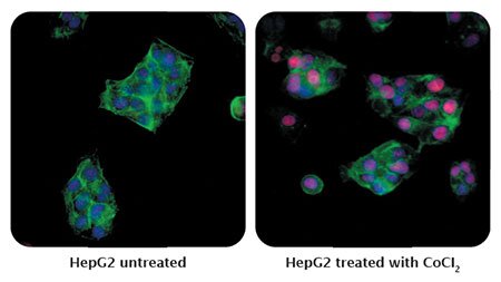 Fluorescence images of HepG2 cells untreated and CoCl₂ treated showing changes in protein localization and expression.