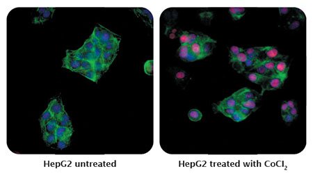 ICC detection of human HIF2-alpha (red) in formaldehyde-fixed asynchronous HepG2 cells untreated or treated with CoCI2 by ICC-IF.