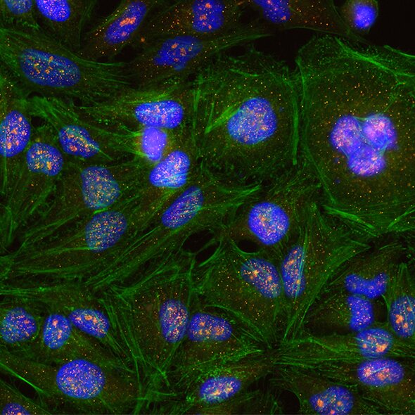 Fluorescent microscopy of cultured cells with blue nuclei, green cytoskeleton, and orange-red puncta distribution