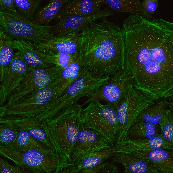 ICC image showing KIF-14 in orange, with other cellular components in green and blue.