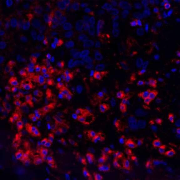 Fluorescence microscopy image showing red-stained proteins with blue-stained cell nuclei