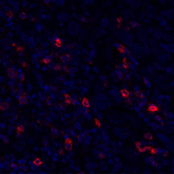 Fluorescence microscopy image showing red-stained cells among blue-stained nuclei in tissue section
