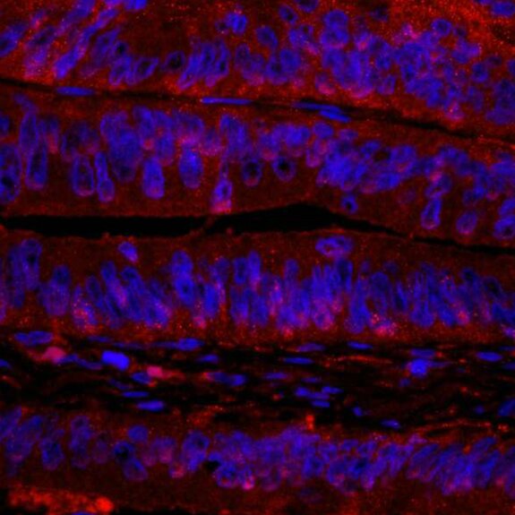 Fluorescent microscopy image showing red-stained tissue with blue-stained nuclei in layered epithelial cells