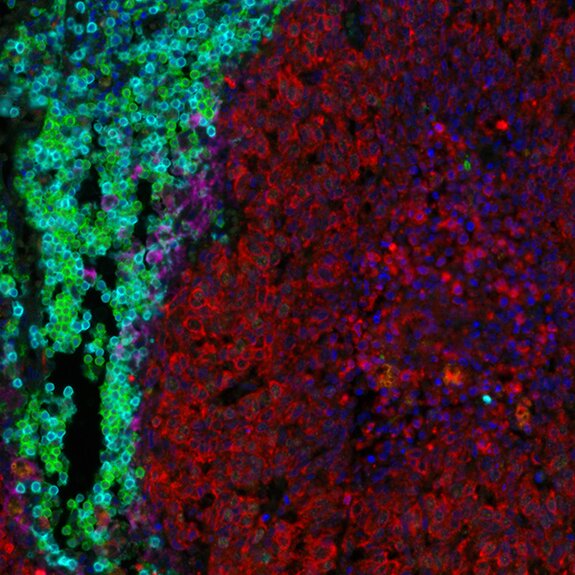 Multiplex immunofluorescence image showing green, red, and blue stained cells highlighting tissue structure and immune interactions.