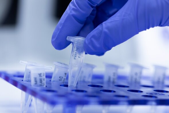 Close up image of scientist hand with reaction tubes to represent Uracil-DNA Glycosylases and their significance in PCR and qPCR