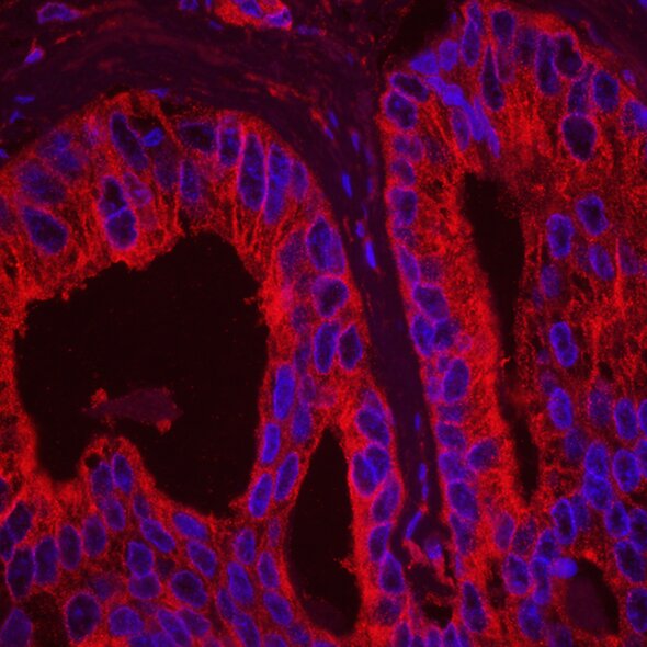 Fluorescent microscopy image showing epithelial tissue with red-stained cell membranes and blue-stained nuclei