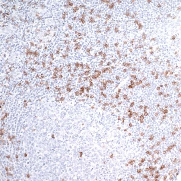 Tissue section showing scattered brown stained cells among pale blue unstained cells on a light background