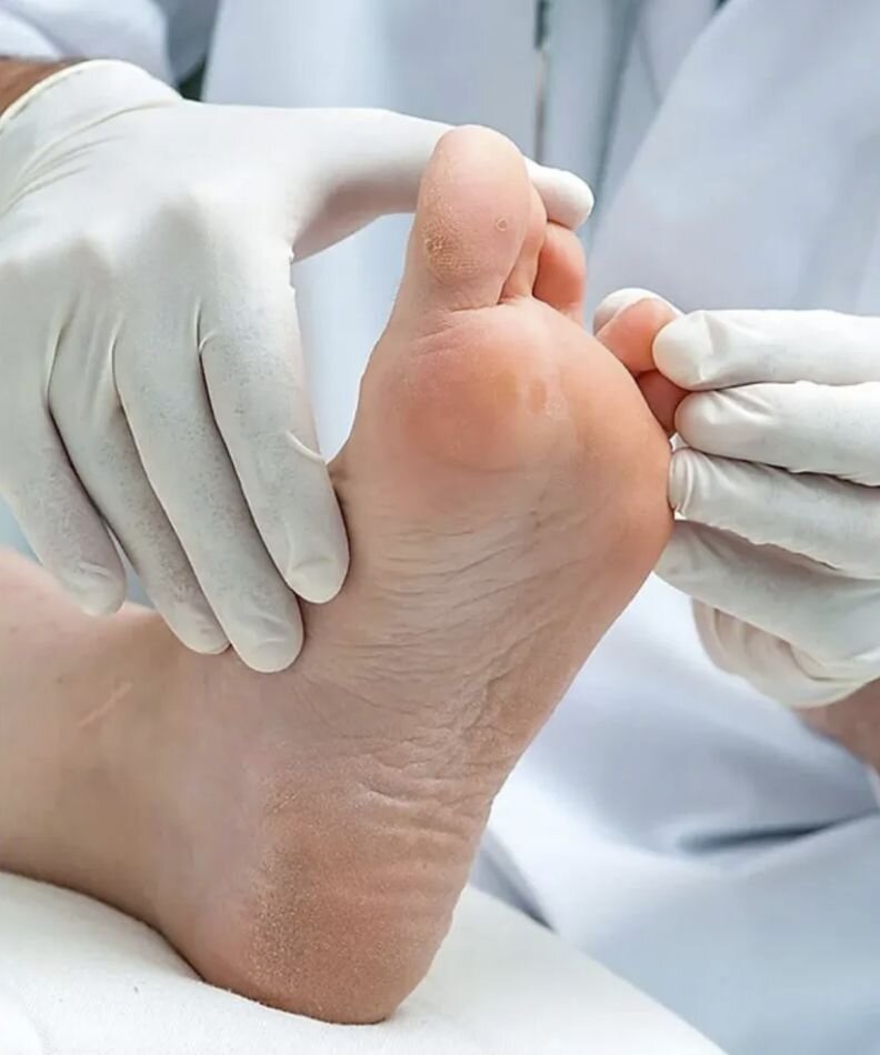 DERMATOLOGÍA DEL PIE