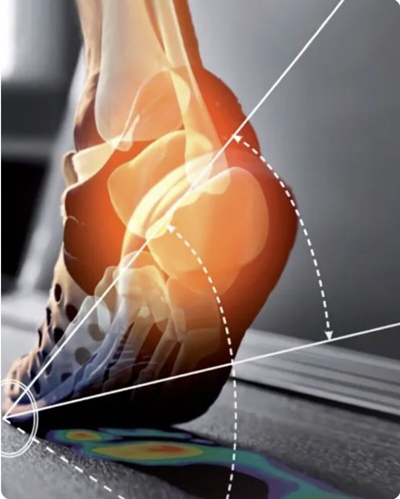 ESTUDIO DE LA PISADA