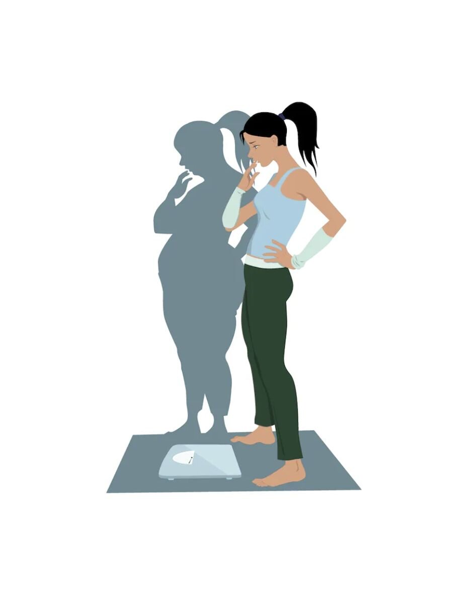 TRASTORNOS EN CONDUCTA ALIMENTARIA