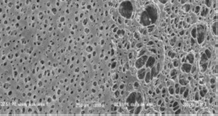 Magnified image of blood separation membrane by Fortis life sciences with 2-3µm pore size on membrane bottom (left side) and 40-50µm pores on membrane top (right side)