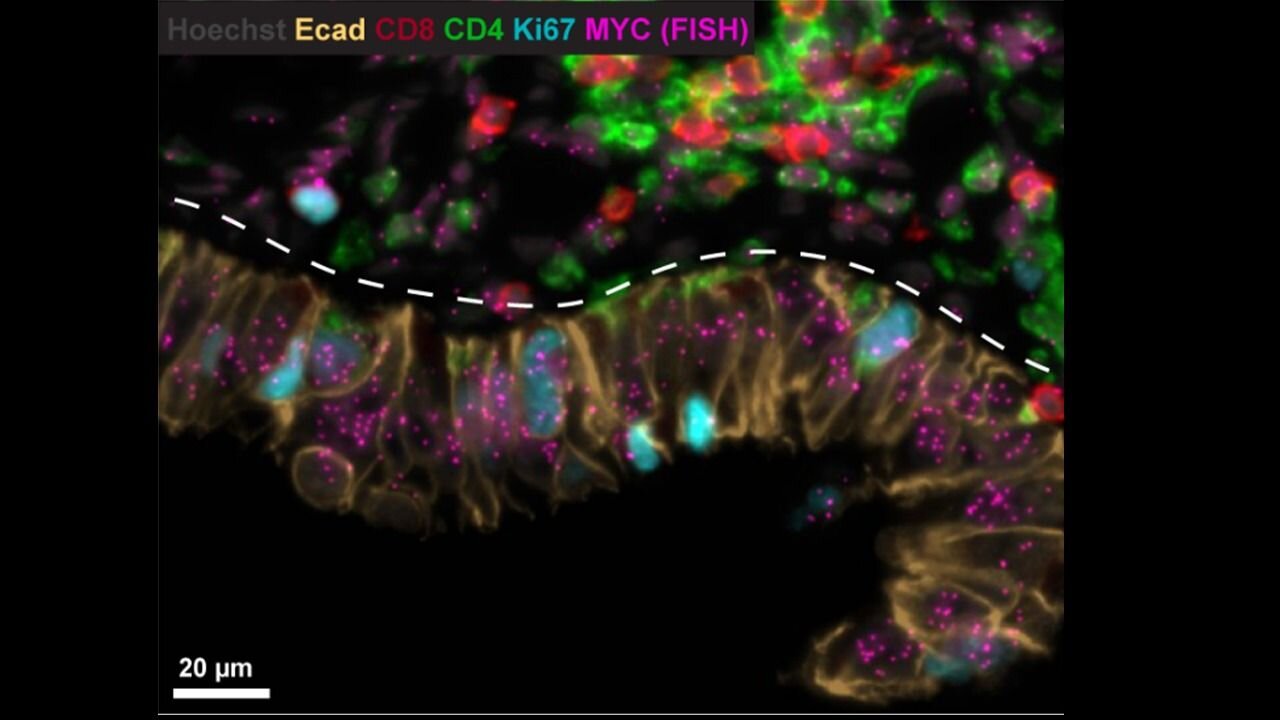 Fluorescence microscopy image of red, green, cyan, magenta, and yellow glowing cells divided by a white dashed boundary on a black background.