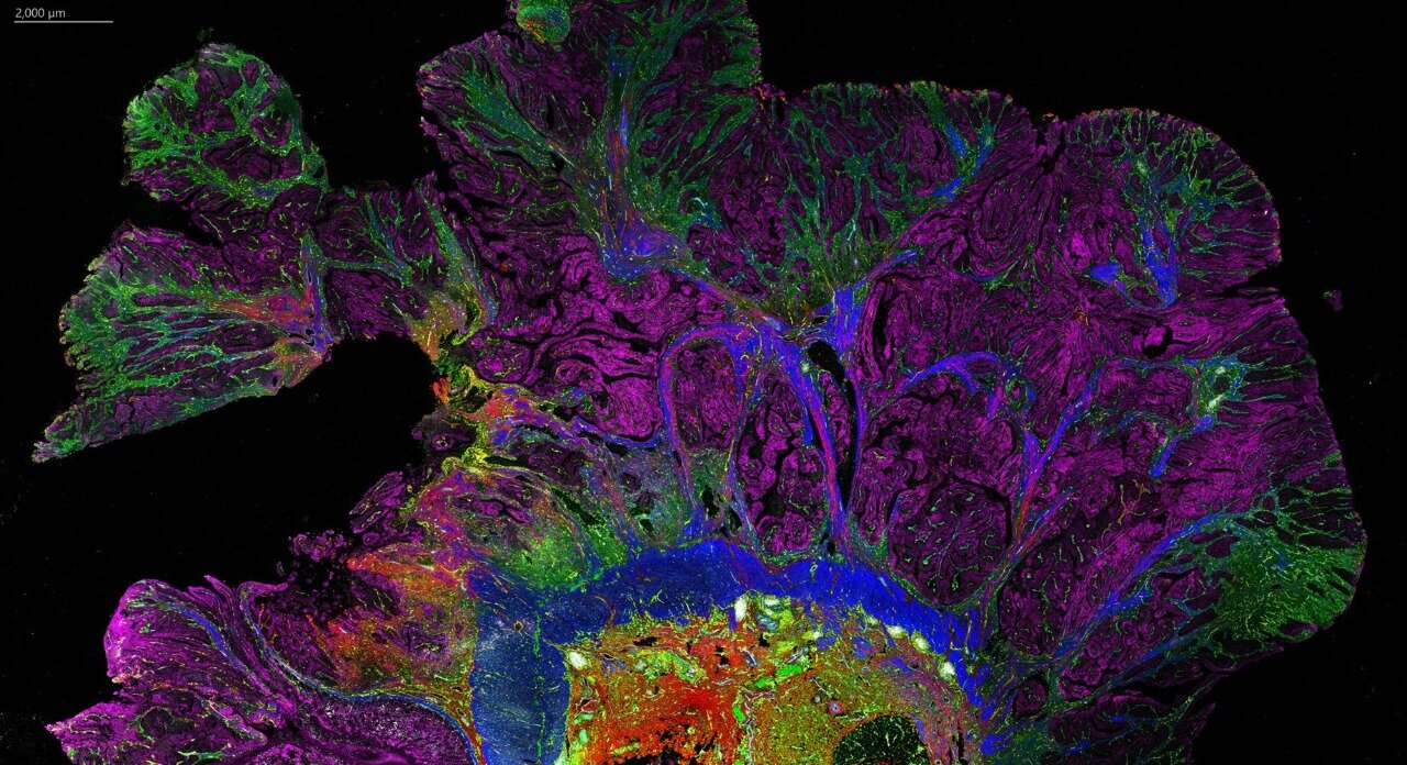 Fluorescence microscopy of tissue sections showing magenta, green, blue, red, and yellow patterns on a black background.