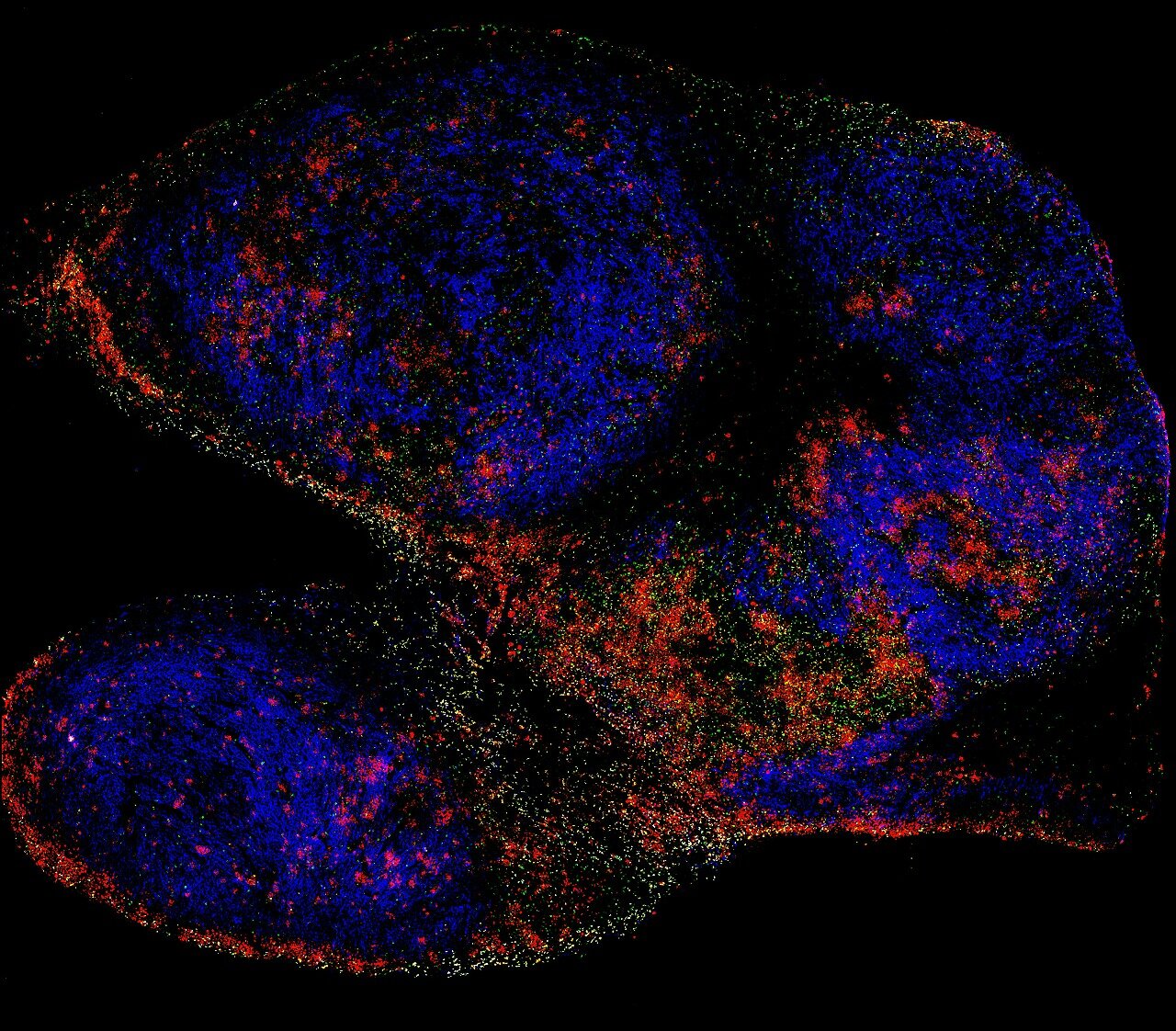 Fluorescence microscopy image of a multi-lobed tissue section with blue, red, orange, and green glowing clusters.