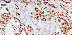 Bethyl Recombinant Monoclonal Antibodies