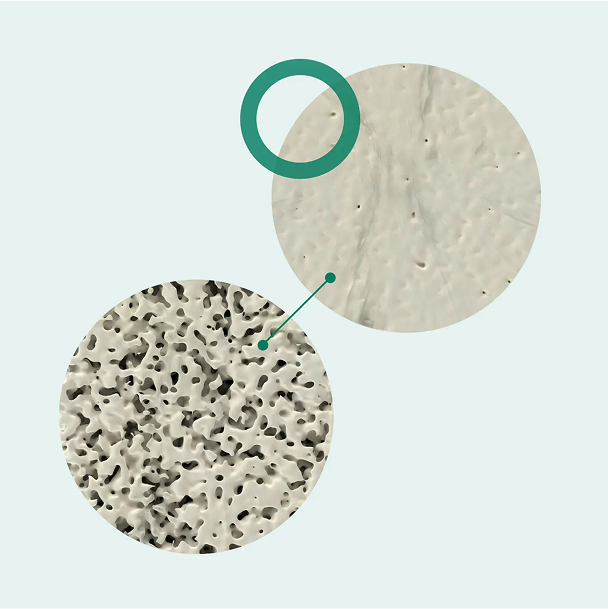 illustration of bone density increasing