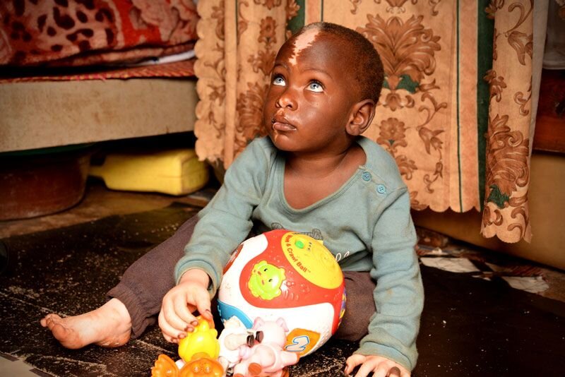 The Story Behind Shakul's Striking Eyes