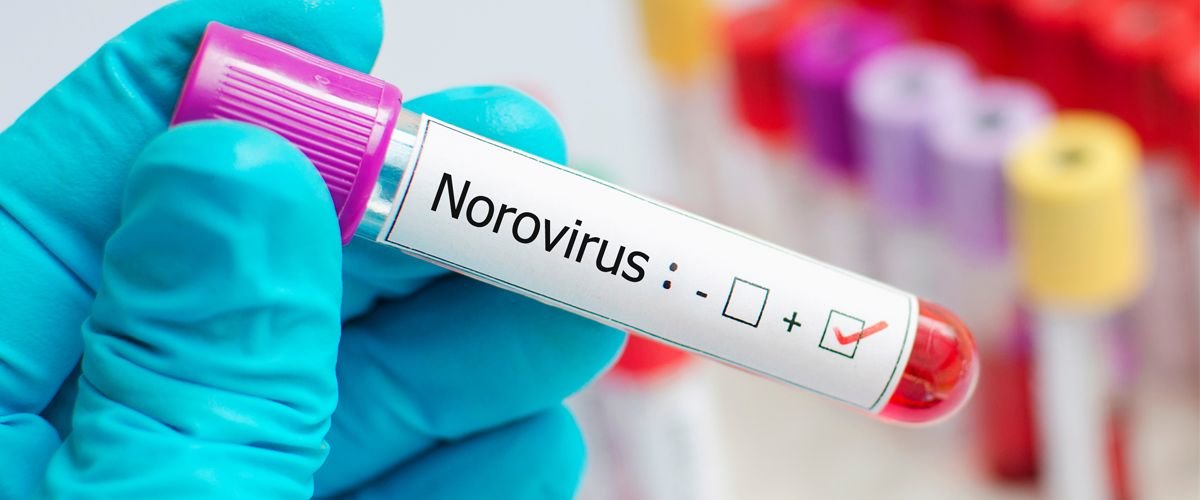 How can we reduce the spread of Norovirus?