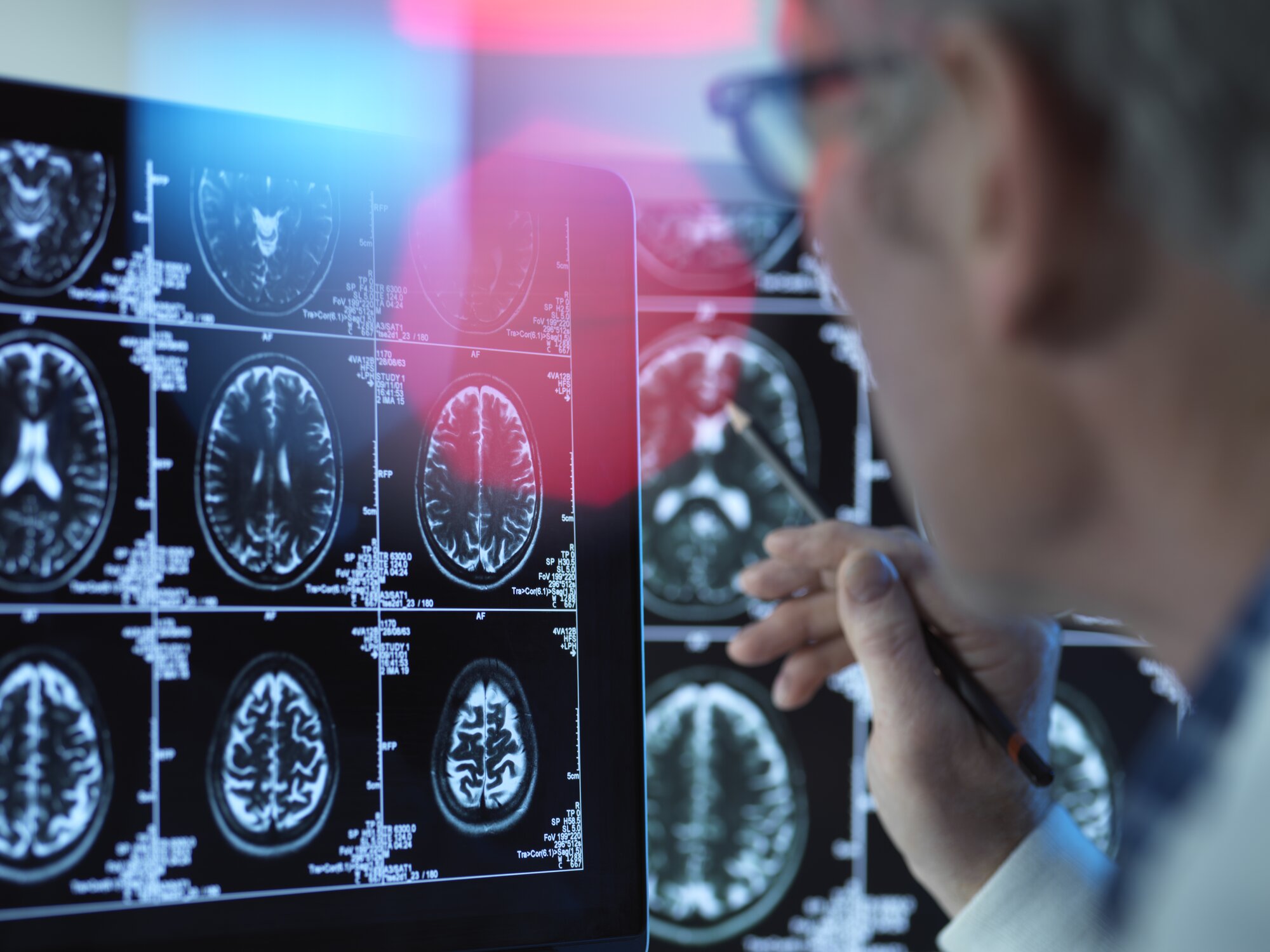 MARKET SNAPSHOT: Neurology Workforce Trends