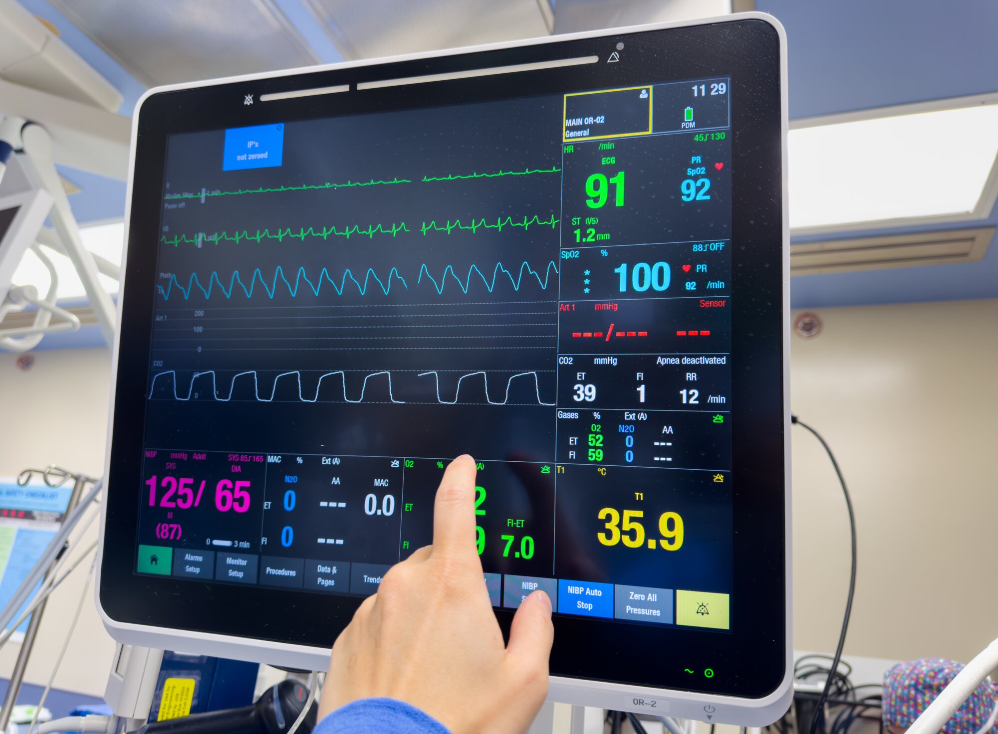 What Does a Telemetry RN Do? A Day in the Life