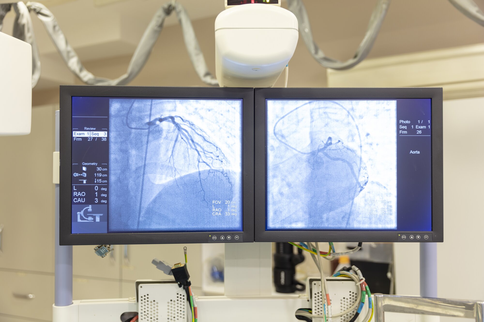 Evaluating Cardiac Cath Lab Tech Opportunities Across Different Care Settings