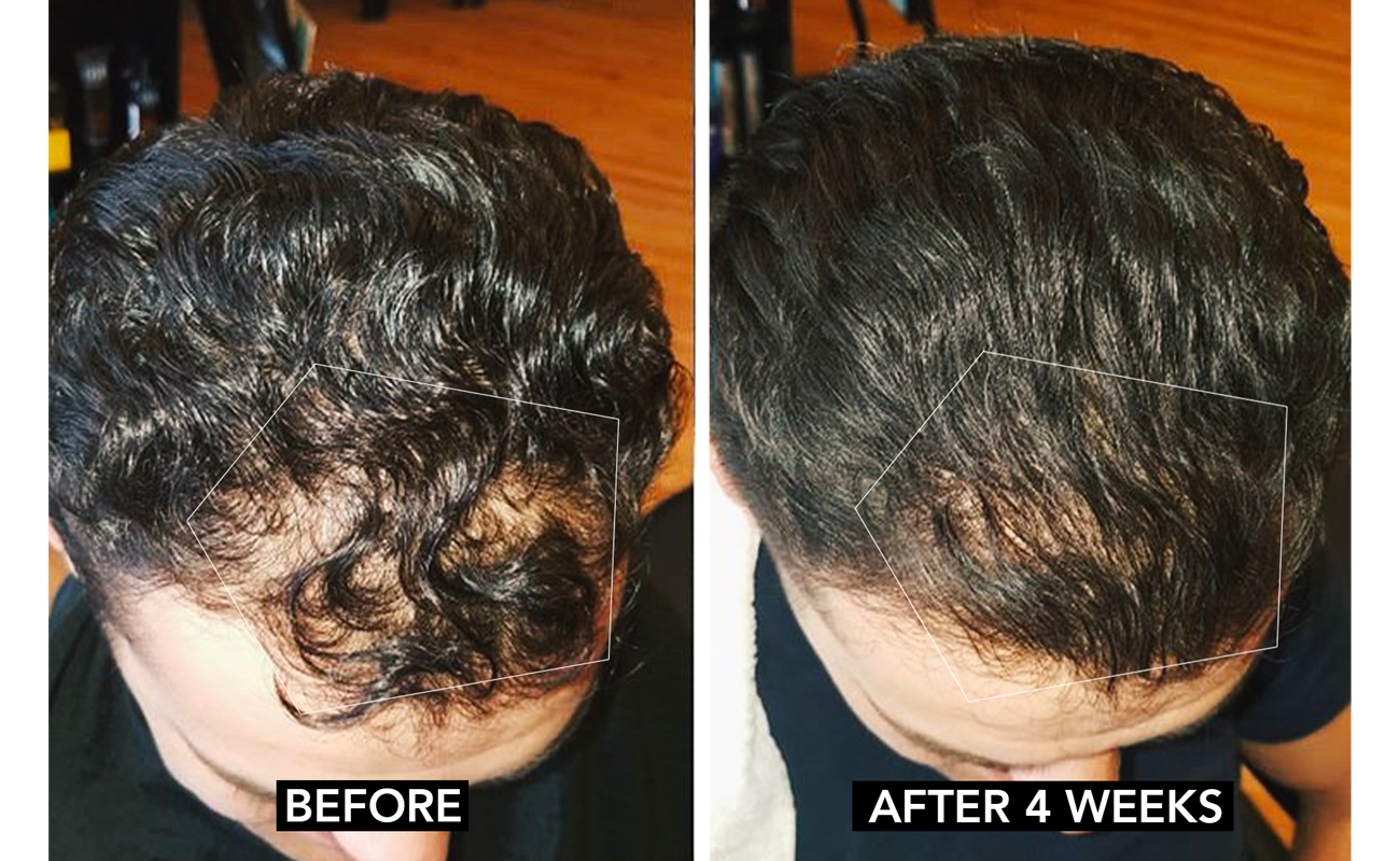 How To Stop Hair Loss At Home