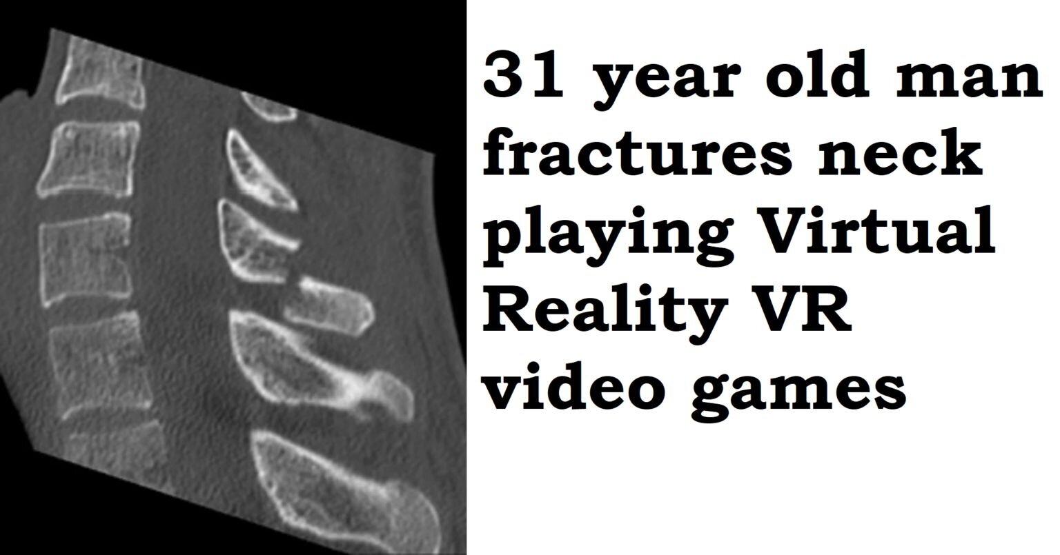 Man fractures neck from daily VR headset use » CGI Clinic
