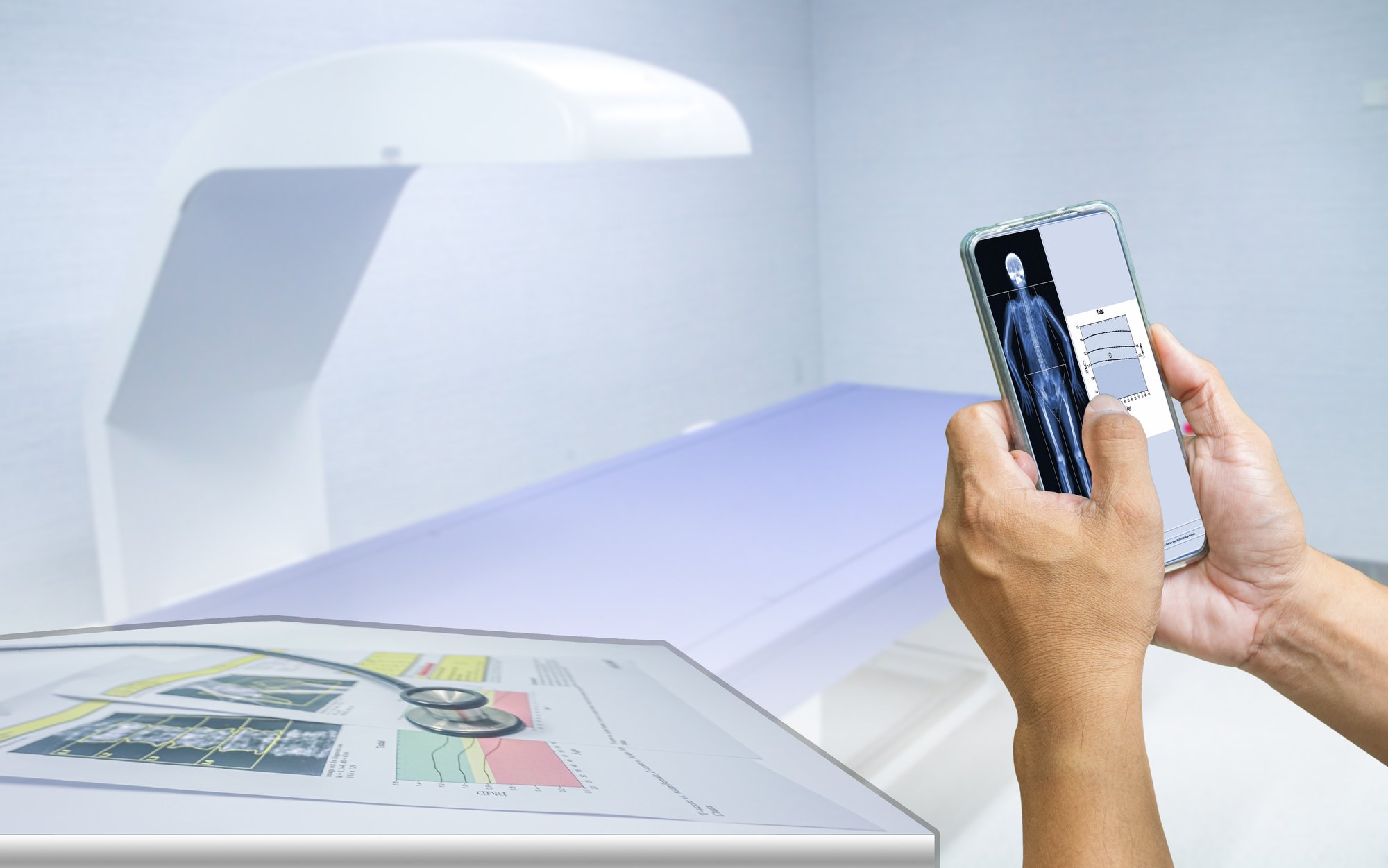 Dexa scan prep here s everything you need to know