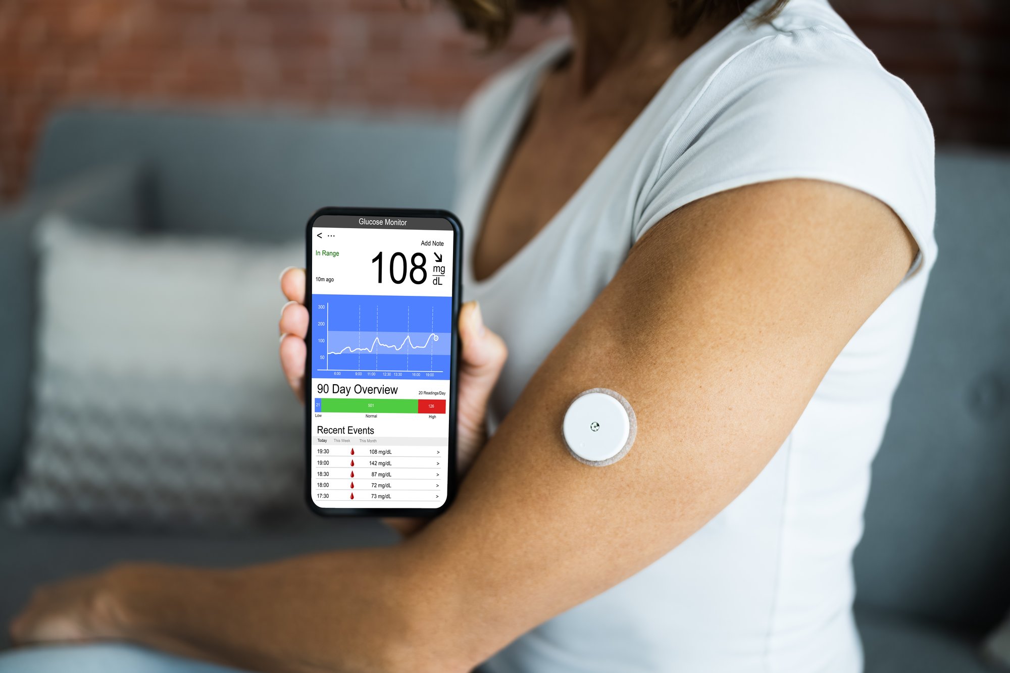 How Does a Continuous Glucose Monitor Work?