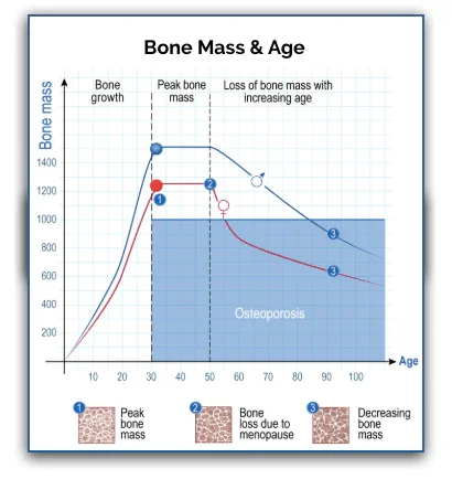 Bone-Dissolving Foods Seniors Must Avoid