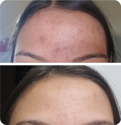 Depoimento sobre resultados do programa detox