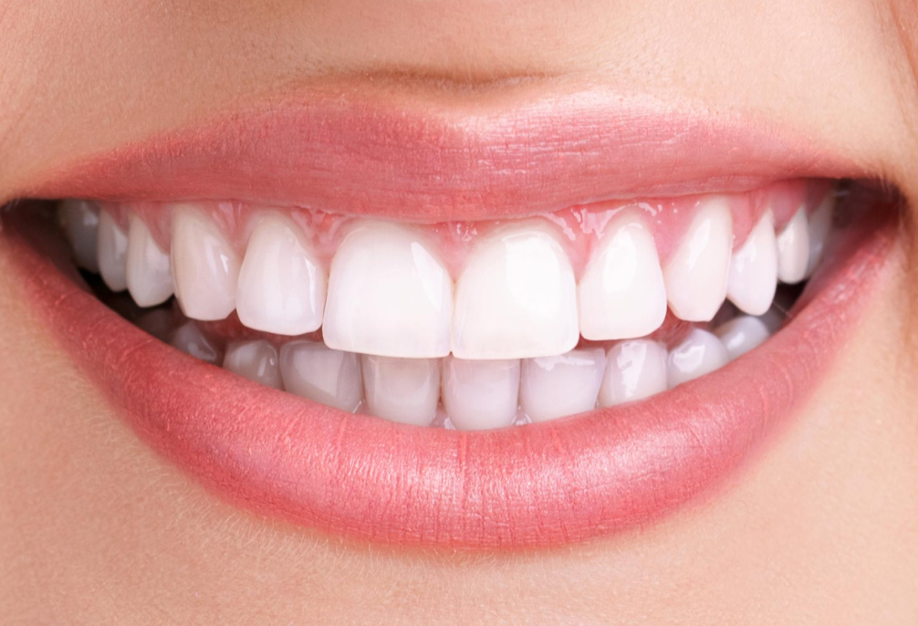 Smile view of teeth