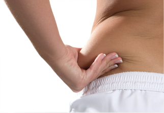 Back Side Belly Fat treatment area