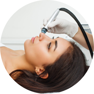 AQUA Peeling treatment illustration