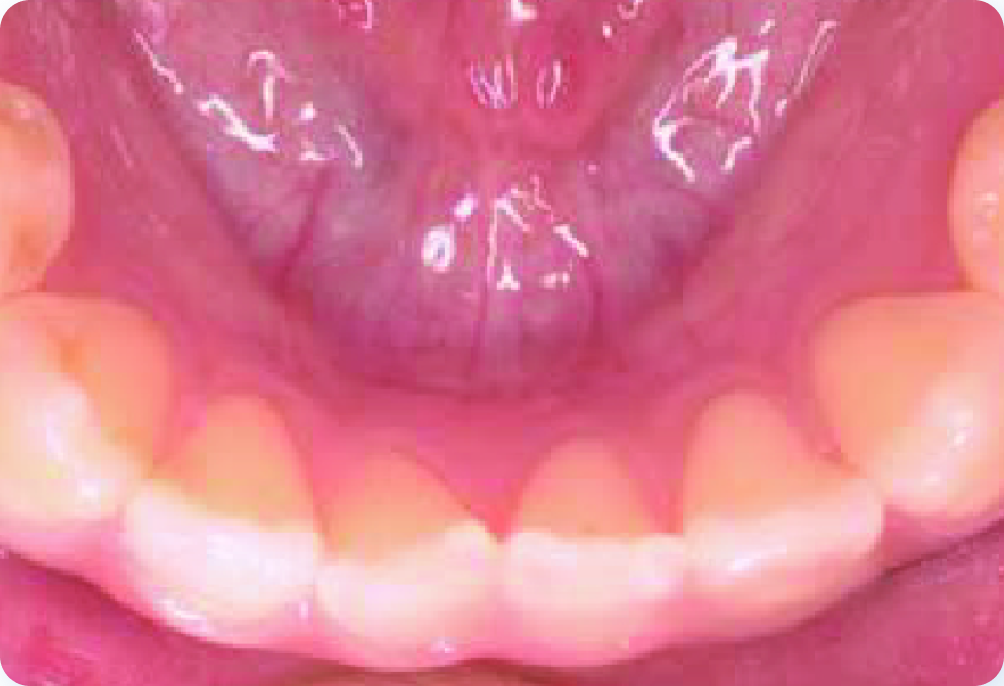 Lower jaw view of teeth
