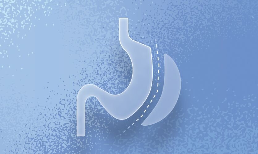 Post metabolic bariatric surgery weight regain: the importance of GLP-1 ...