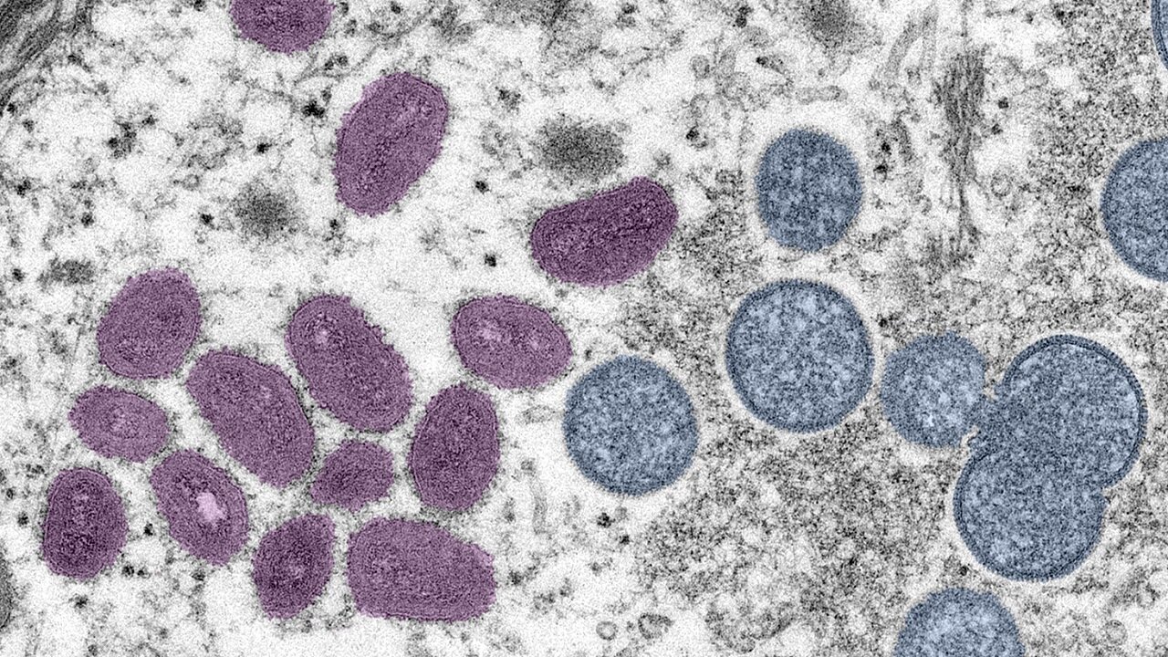 Second monkeypox case in Colorado announced, waiting for CDC ...