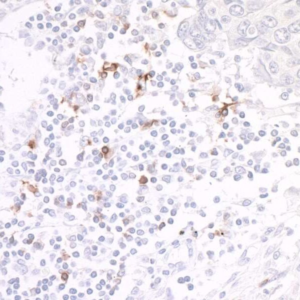 Role of OX40 in T Cell Biology of Cancer and Infectious Disease ...