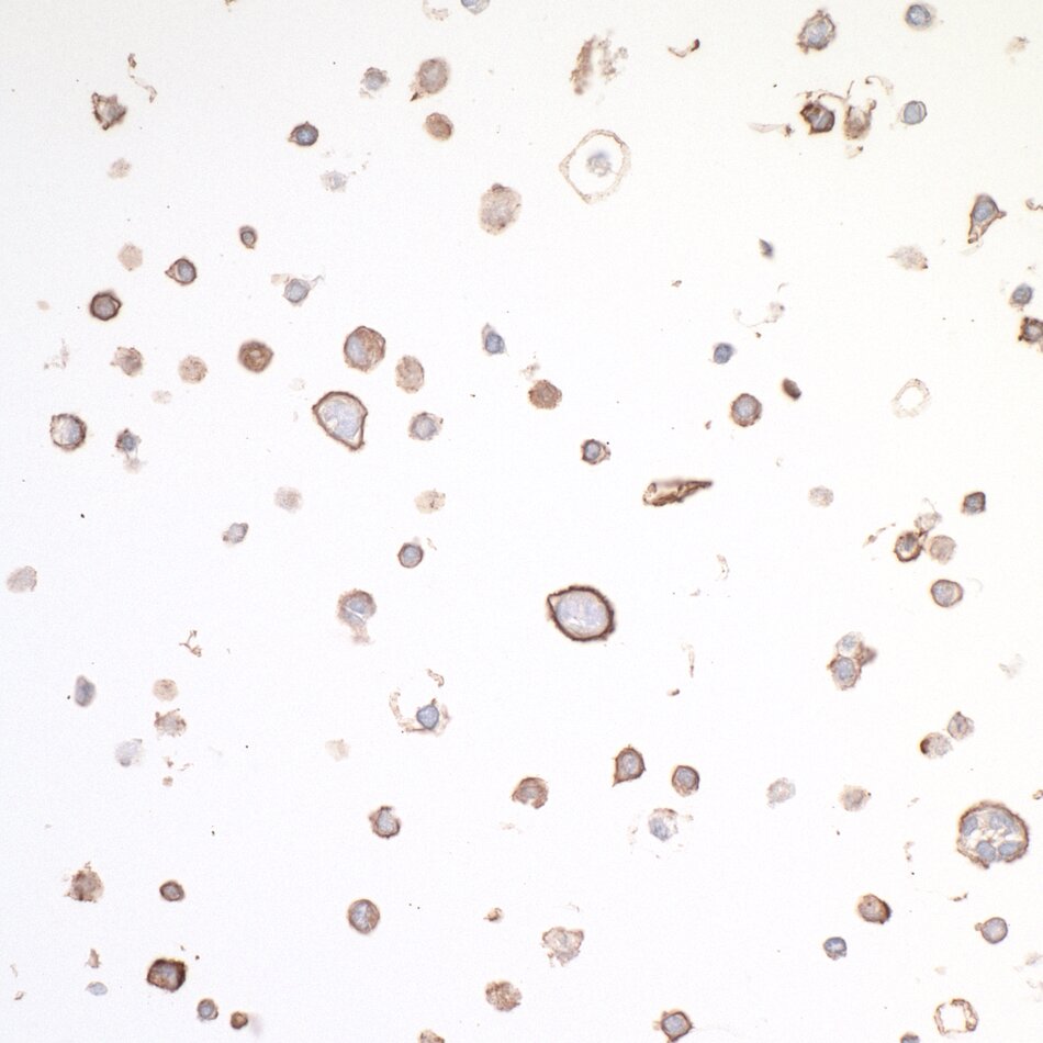 Role of OX40 in T Cell Biology of Cancer and Infectious Disease ...