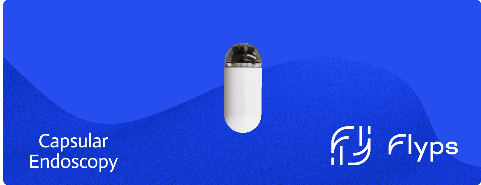 AI Powered Endoscopic Capsule Revolutionizing Diagnostics