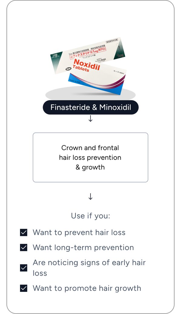 Men's Hair Loss | elife